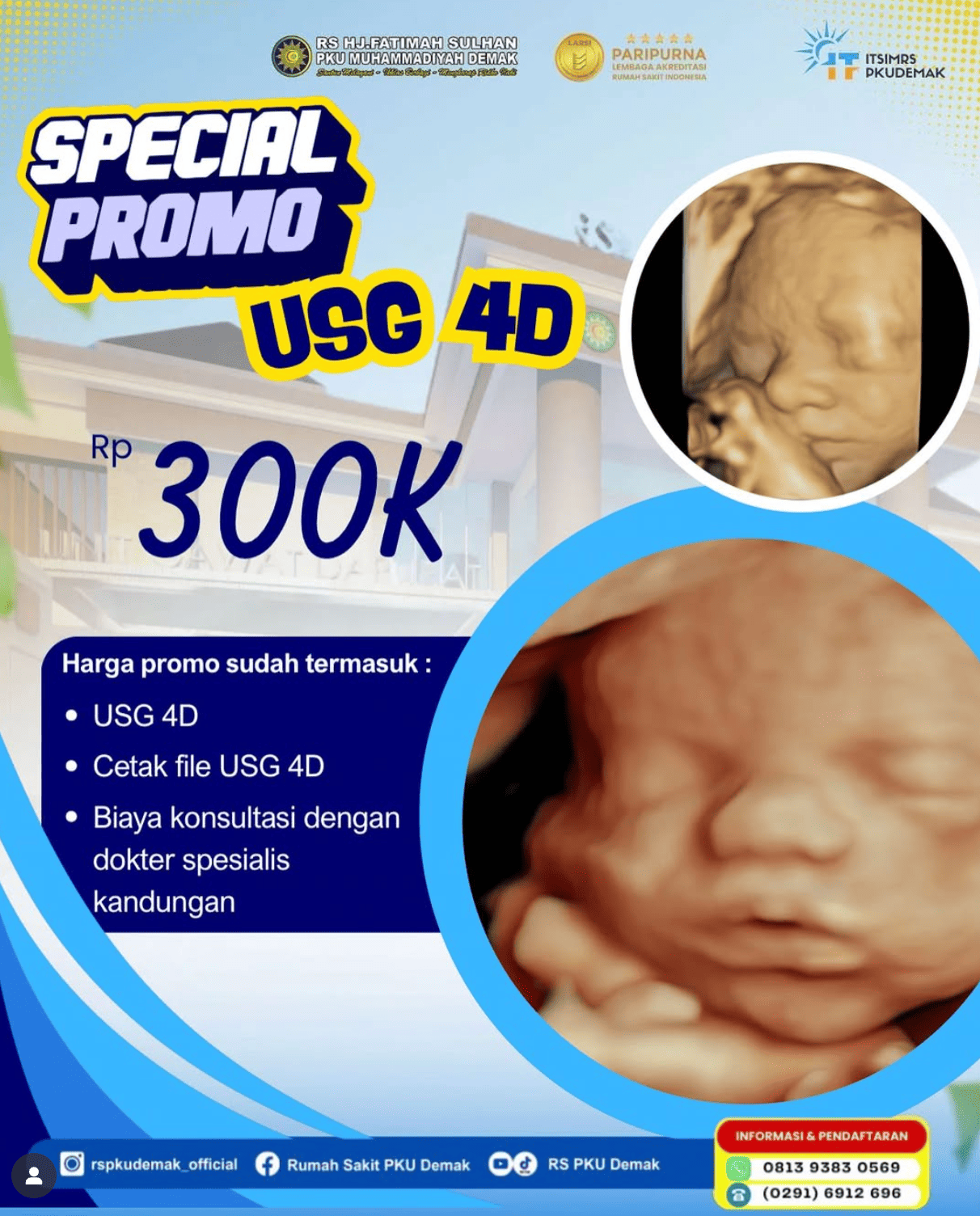 SPECIAL PROMO USG 4D